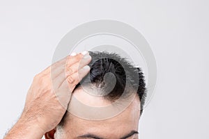 Portrait Asian man with worry feeling and touching on his head to show bald head or Glabrous problem. Studio shoot with copy space