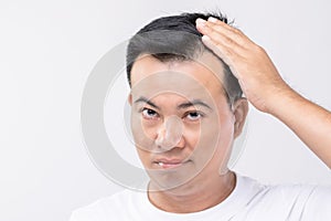 Portrait Asian man with worry feeling and touching on his head to show bald head or Glabrous problem. Studio shoot with copy space