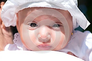 Portrait of a baby girl with blocked tear ducts of one eye