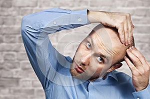 Portrait of a bald man looking at his balding head with a short haircut in a blue shirt. Hair transplant concept: white sad