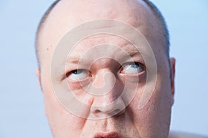 Portrait of a bald man who bulged his eyes.