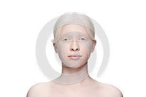 Portrait of beautiful albino woman isolated on white studio background. Beauty, fashion, skincare, cosmetics concept.