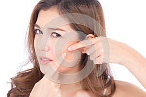 Portrait of beautiful woman asian is a acne, zit treatment, girl problem beautiful face photo