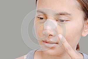 Portrait of beautiful young female face with bandage on her nose - beauty treatment plastic surgery isolated on gray background