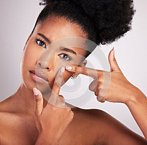 Portrait, black woman and squeeze face for pimple in studio, background and hands press acne scar. Female model check