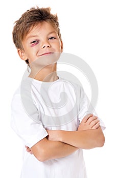 Portrait of boy with bruise photo