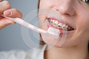 Portrait of a caucasian woman with braces on her teeth holding a toothbrush.