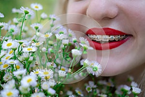 portrait of a charming blonde teenage girl wearing teeth braces with bouquet of white wildflowers. female with braces in