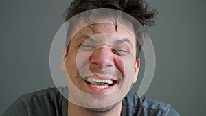 Portrait of crazy laughter of a drunk or drugged young man looking at camera.