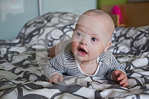 Portrait of cute baby boy with Down syndrome