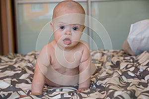 Portrait of cute baby boy with Down syndrome