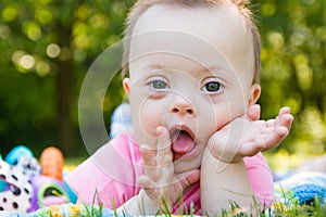 Portrait of Cute baby boy with Down syndrome lying on blanket in summer day on nature