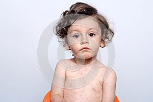 Portrait of a cute sick baby boy.