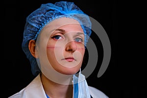 Portrait of a doctor with cuts and red eyes. Close-up of a nurse in a face mask on a black background with traces of protective