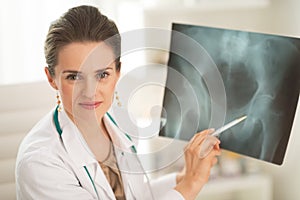 Portrait of doctor woman pointing on fluorography photo