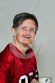 Portrait of an Elderly Downs Syndrome Man with No Teeth He is Ho