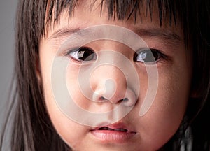 Portrait face of Asian little child girl with sad expression on dark background