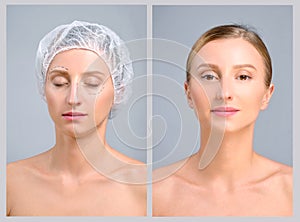 Portrait of female face, before and after plastic surgery