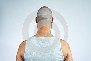 Portrait of a head bald man with alopecia, back view