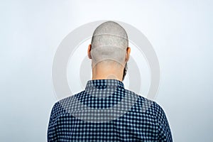 Portrait of head bald man with alopecia, back view