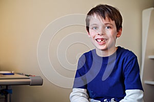 Portrait of little boy who lost his milk tooth