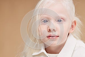 Portrait of little girl with albinism syndrome