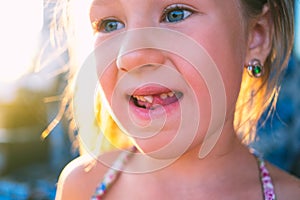 Portrait of a little girl with an outstretched milk tooth