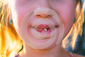 Portrait of a little girl with an outstretched milk tooth