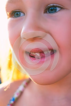 Portrait of a little girl with an outstretched milk tooth