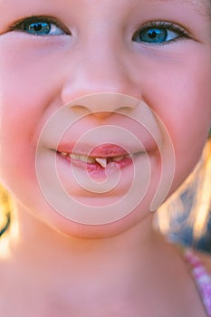 Portrait of a little girl with an outstretched milk tooth