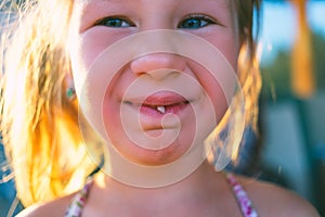 Portrait of a little girl with an outstretched milk tooth