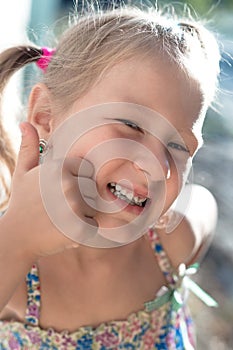 Portrait of a little girl with a wobbly baby tooth and a thumb up