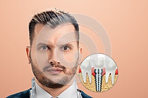 A portrait of a man depicting a dental implant in his jaw. Dentistry concept, prosthetics, dentist service cost. Copy space