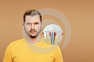 A portrait of a man depicting a dental implant in his jaw. Dentistry concept, prosthetics, dentist service cost. Copy space