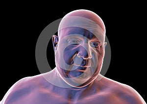 A portrait of a man with overweight body composition, 3D illustration highlighting the physiological implications of