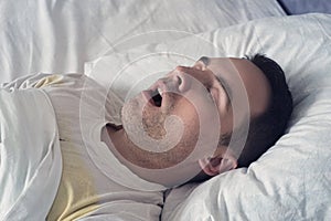 Portrait of a man sleeping with an open mouth. problem of snoring during sleep. A young cute guy sleeps on a white bed