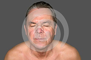 Portrait of a middle aged man with a nose tape and eyes closed