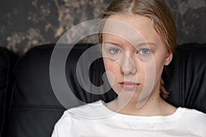 The portrait of pimply teenager girl with blue eyes and blond hair in white t-shirt photo
