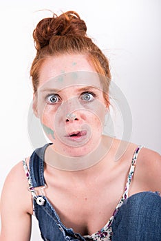 Portrait red-haired woman with color spots in the face