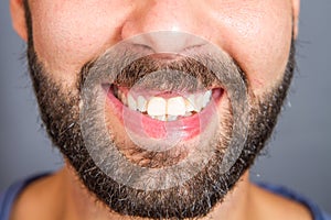 Portrait of smiling beared man