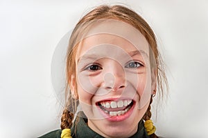 Portrait smiling girl of 9 years old with a missing milk tooth in the gums. The child's baby tooth fell out. On a white