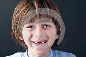 Portrait of a smiling toothless boy