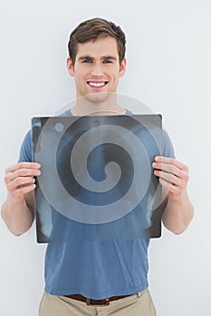 Portrait of a smiling young man holding lung xray