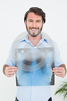 Portrait of a smiling young man holding lung xray