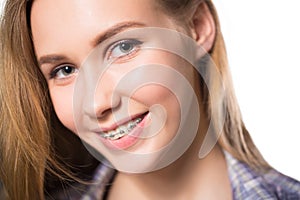 Portrait of teen girl showing dental braces.