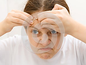 Portrait of a teenage girl with bad emotion - she removes pimples from her forehead, touches her face, acne on the skin, concept