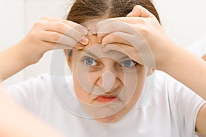 Portrait of a teenage girl with bad emotion - she removes pimples from her forehead, touches her face, acne on the skin, concept