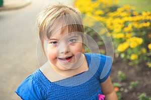 A portrait of trisomie 21 child girl outside having fun on a park