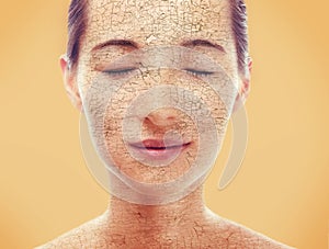 Portrait of woman with dry skin