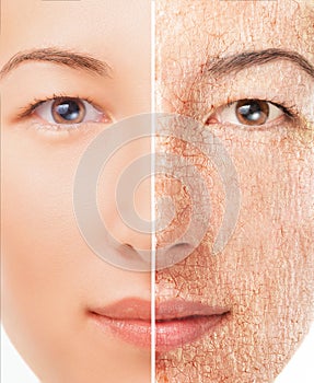 Portrait of woman with problem skin